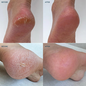 Voesh - Solemate Heel Repair Balm Lavender